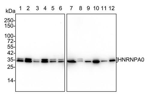 HNRNPA0 Antibody (PSH02-77)