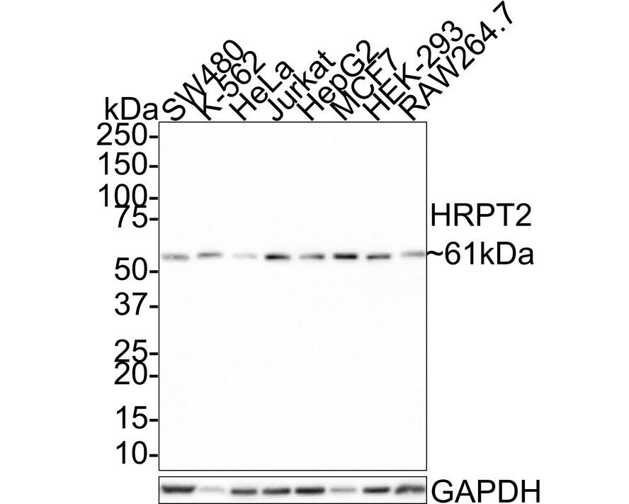 CDC73/HRPT2 Antibody (JE66-42)