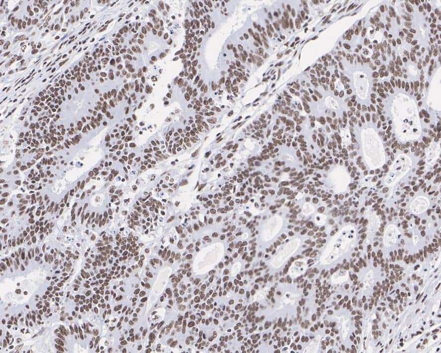 HSF1 Antibody (JE44-79)