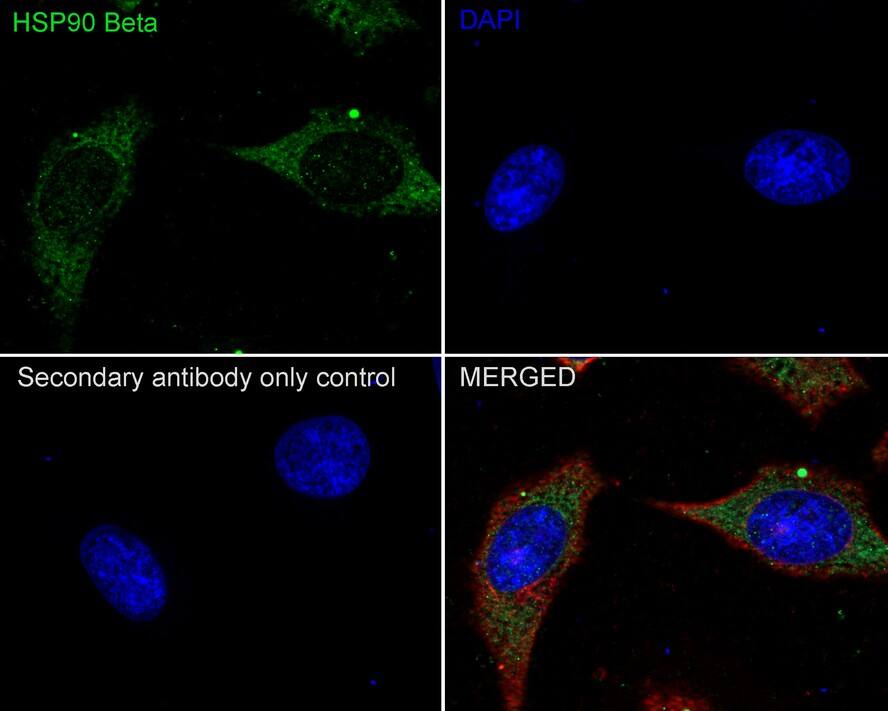 HSP90 beta Antibody (2-1-G3-R)