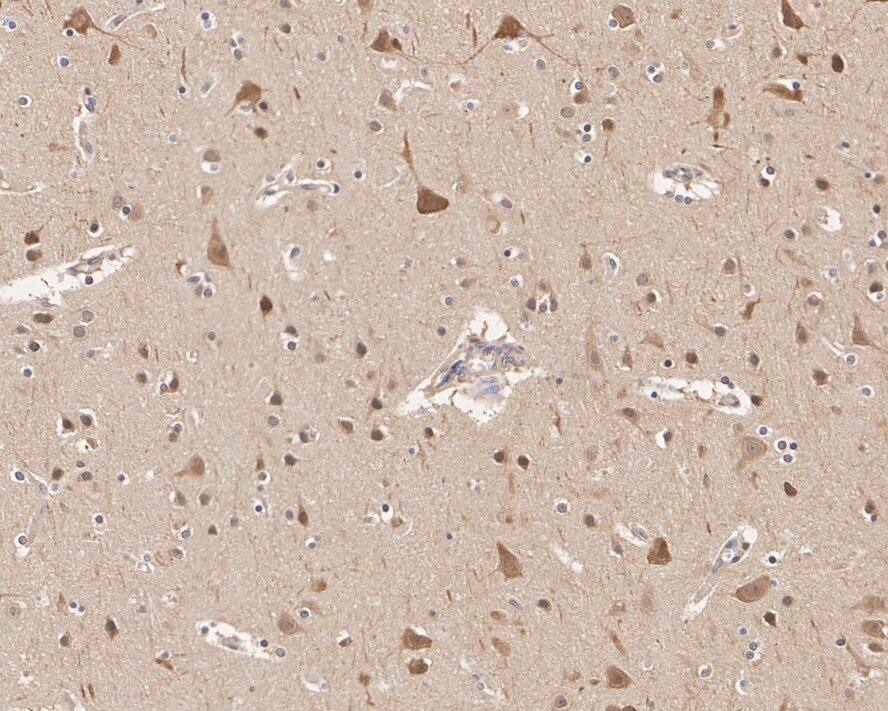 HSP90 beta Antibody (2-1-G3-R)