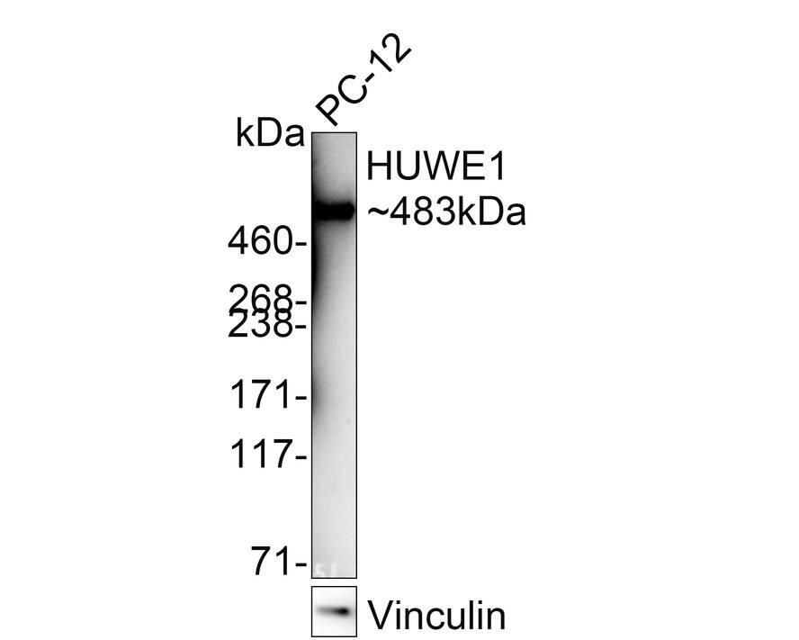 HUWE1 Antibody (PSH02-38) Western Blot: HUWE1 Antibody (PSH02-38) [NBP3-32455]