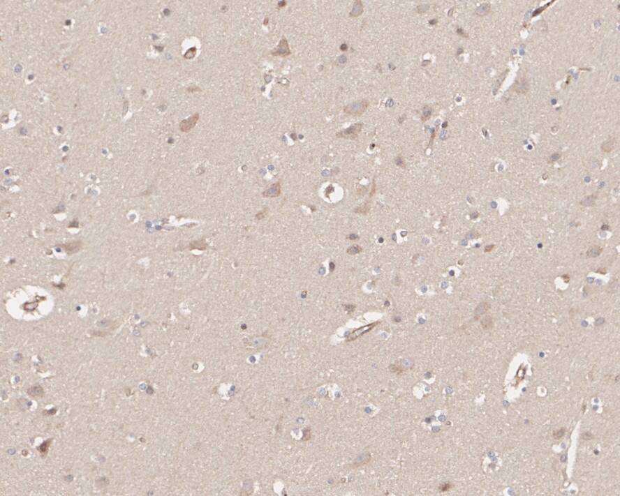 HUWE1 Antibody (PSH02-38)