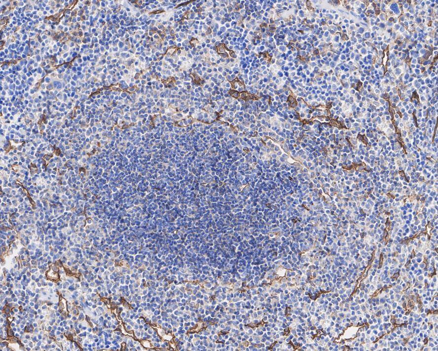 ICAM-2/CD102 Antibody (JE63-28)