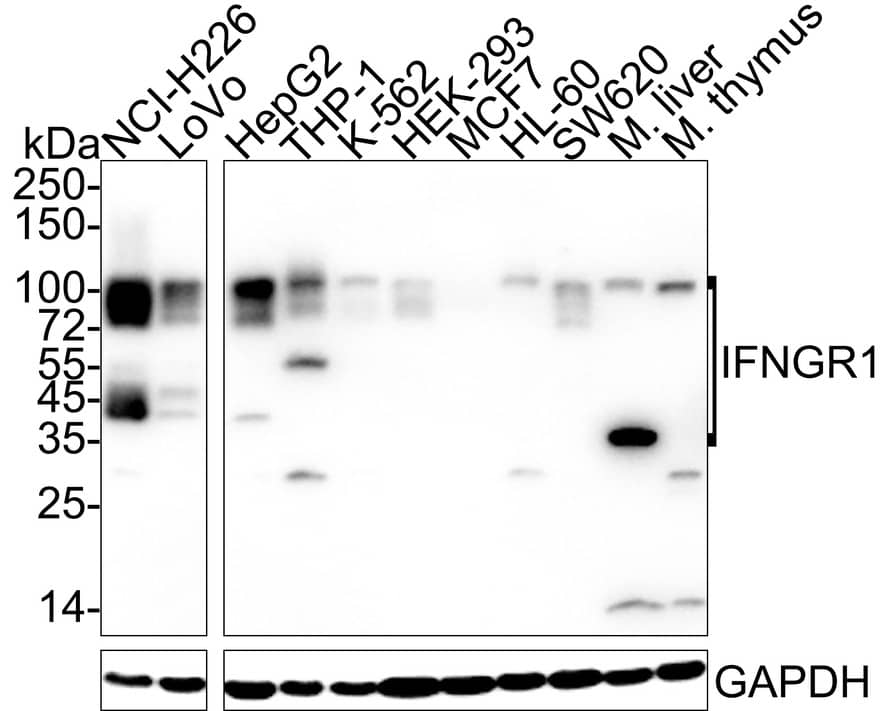 IFN-gamma R1/CD119 Antibody (JE40-50)