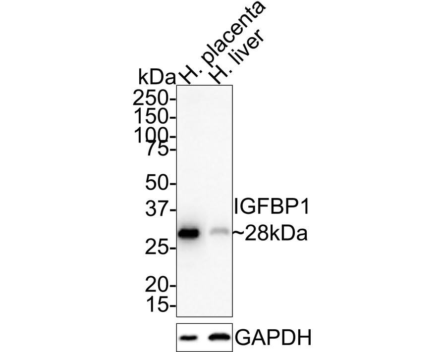 IGFBP-1 Antibody (JE35-39)