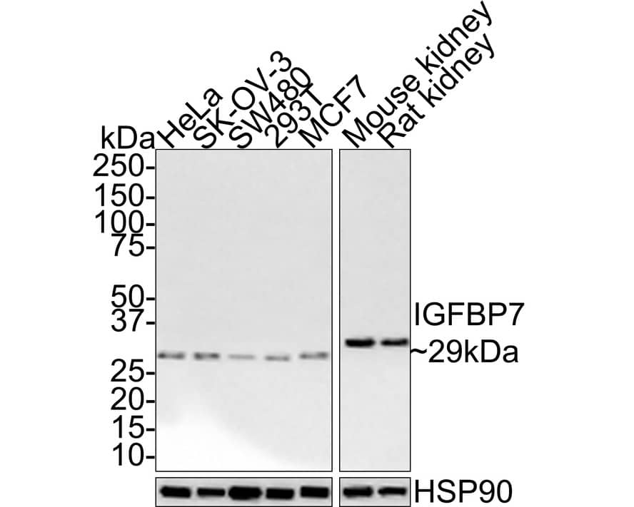 IGFBP-rp1/IGFBP-7 Antibody (JE34-01)