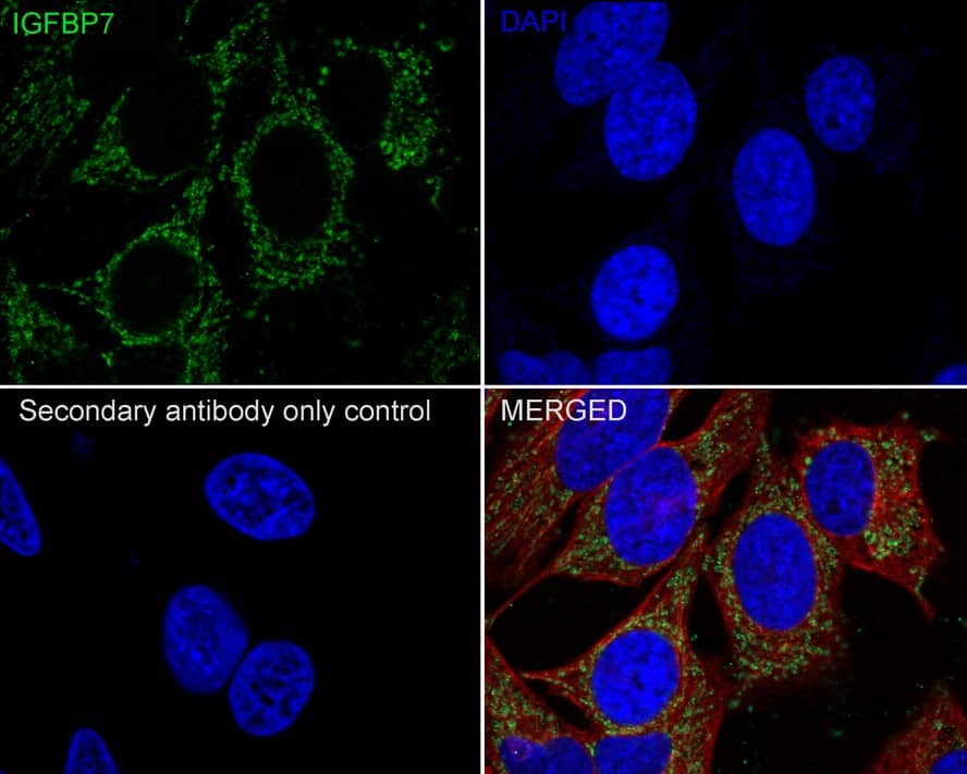 IGFBP-rp1/IGFBP-7 Antibody (JE34-01)