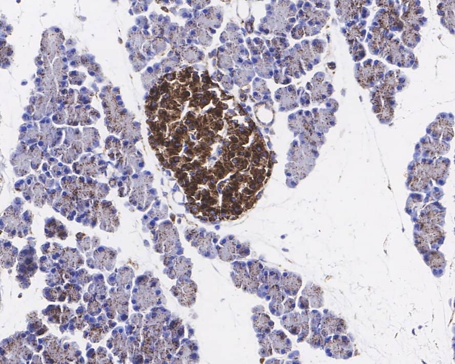 IGFBP-rp1/IGFBP-7 Antibody (JE34-01)