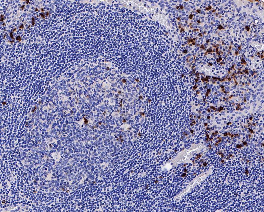 IgJ Antibody (PD00-89)