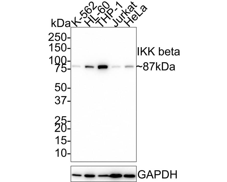 IKK beta Antibody (JE32-81)