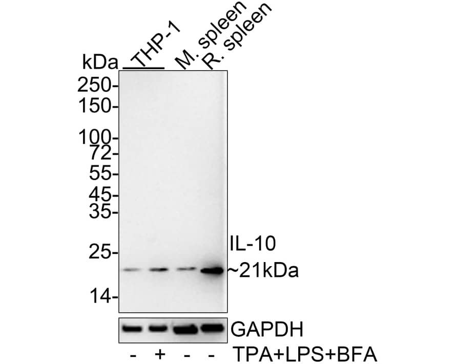 IL-10 Antibody (JE59-71) Western Blot: IL-10 Antibody (JE59-71) [NBP3-32465]