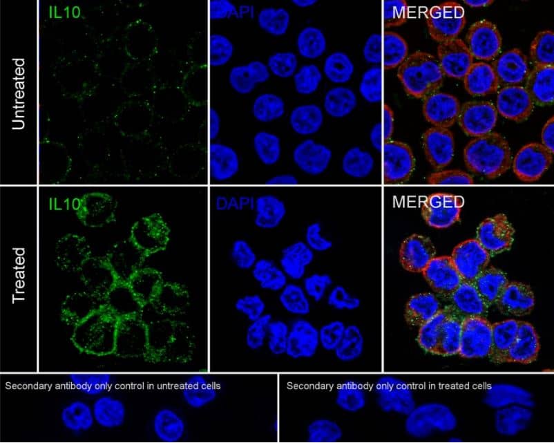 IL-10 Antibody (JE59-71)