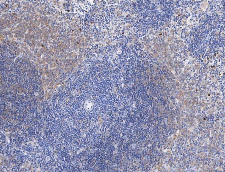 IL-10 Antibody (JE59-71)