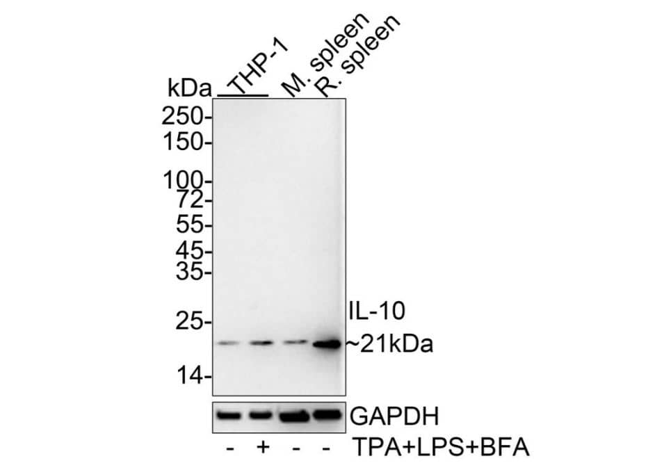 IL-10 Antibody (JE59-71)