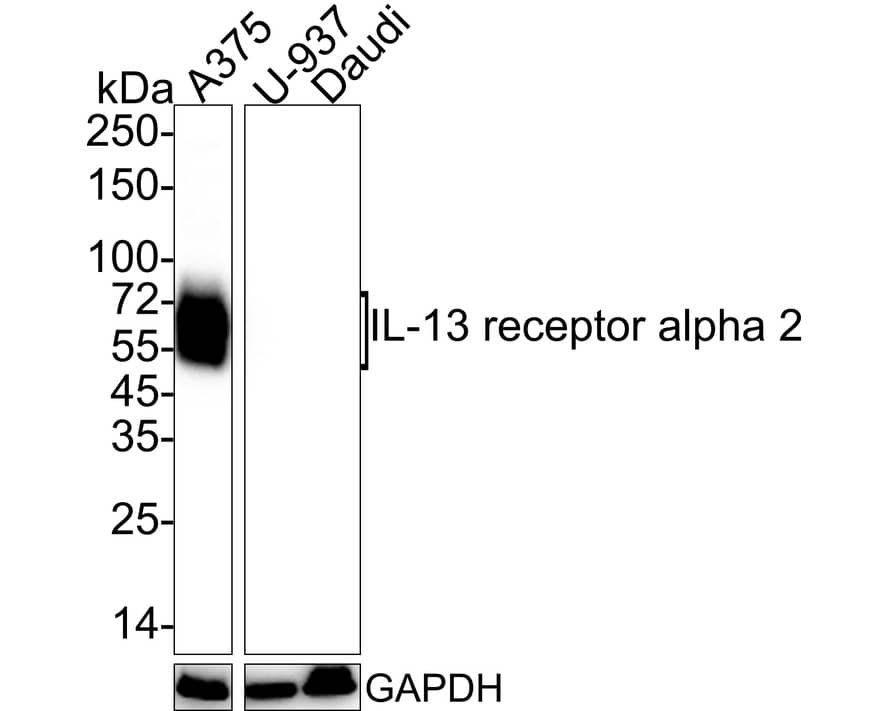 IL-13R alpha 2 Antibody (PSH03-85)