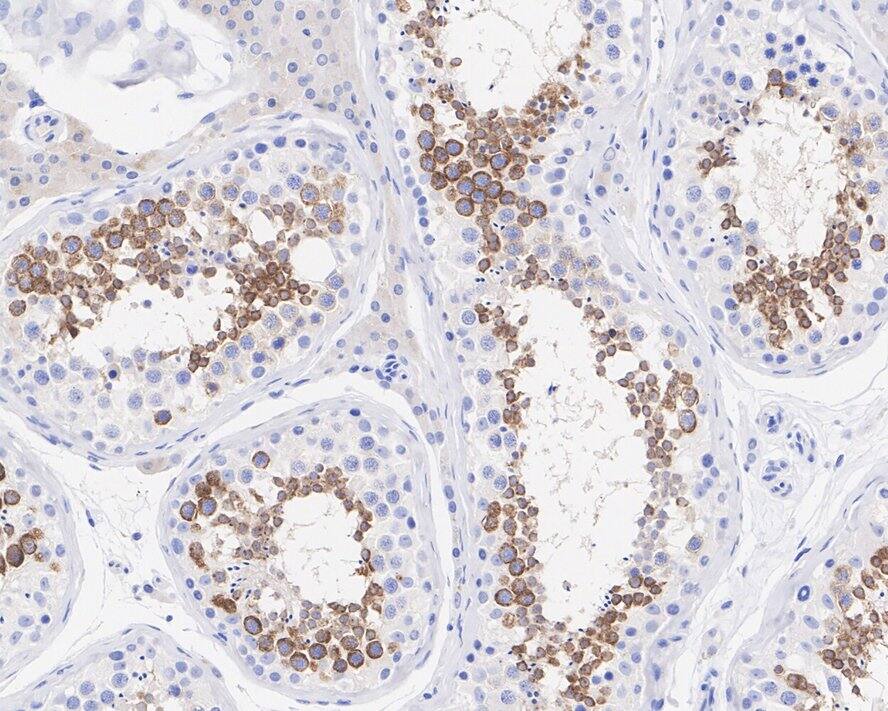 IL-13R alpha 2 Antibody (PSH03-85)