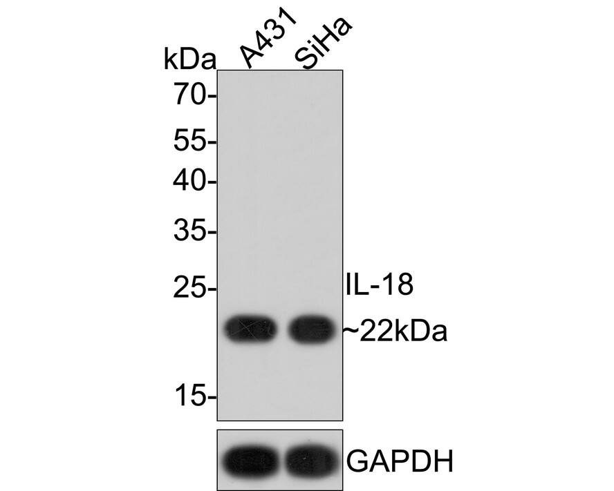 IL-18/IL-1F4 Antibody (PS01-06)