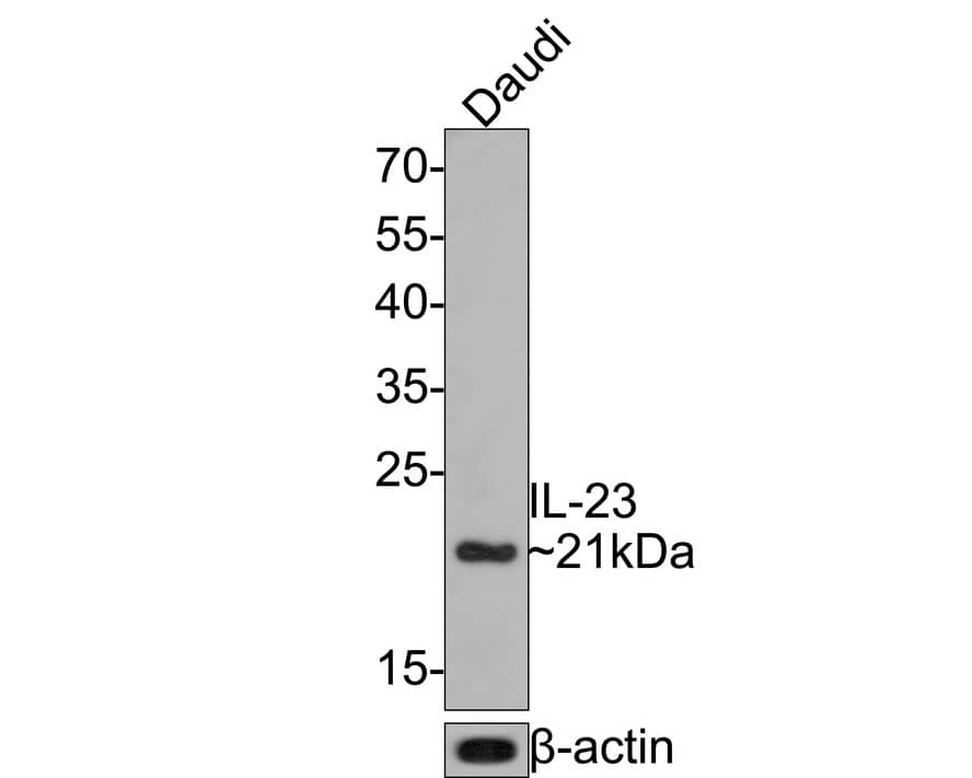 IL-23 Antibody (JE38-99)