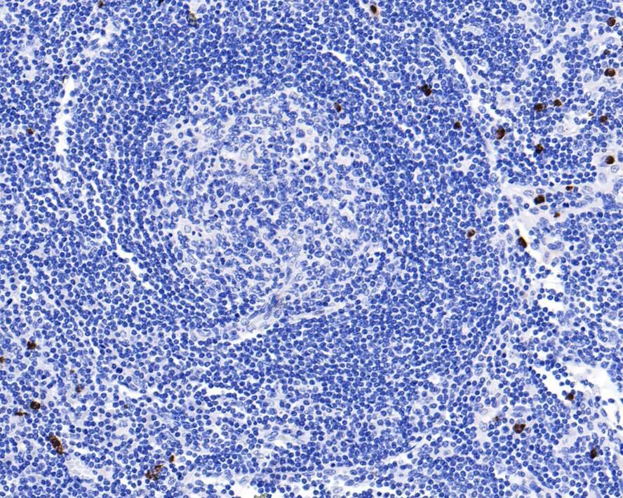 IL-23 Antibody (JE38-99)