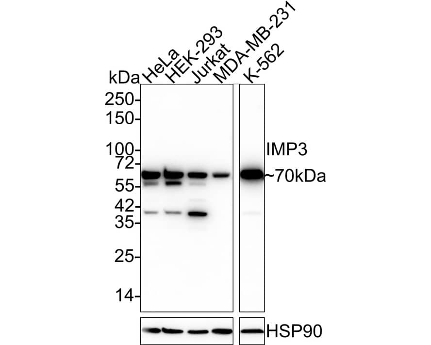 IGF2BP3 Antibody (JE34-04)