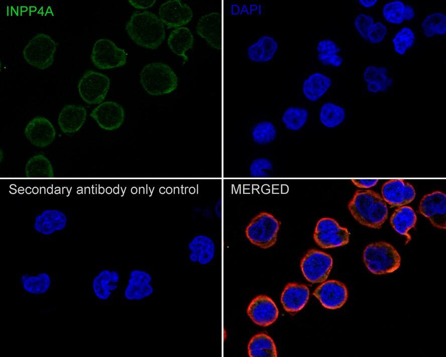 INPP4A Antibody (PSH01-27)