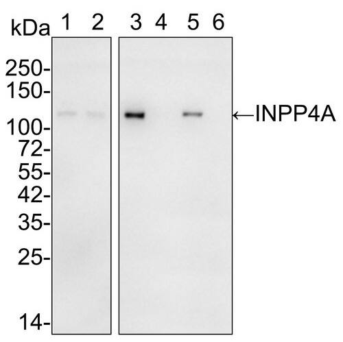 INPP4A Antibody (PSH01-27)