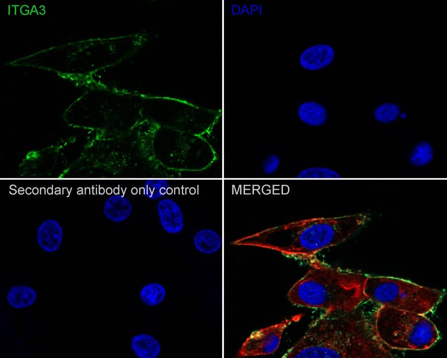 Integrin alpha 3/CD49c Antibody (A7H2-R)