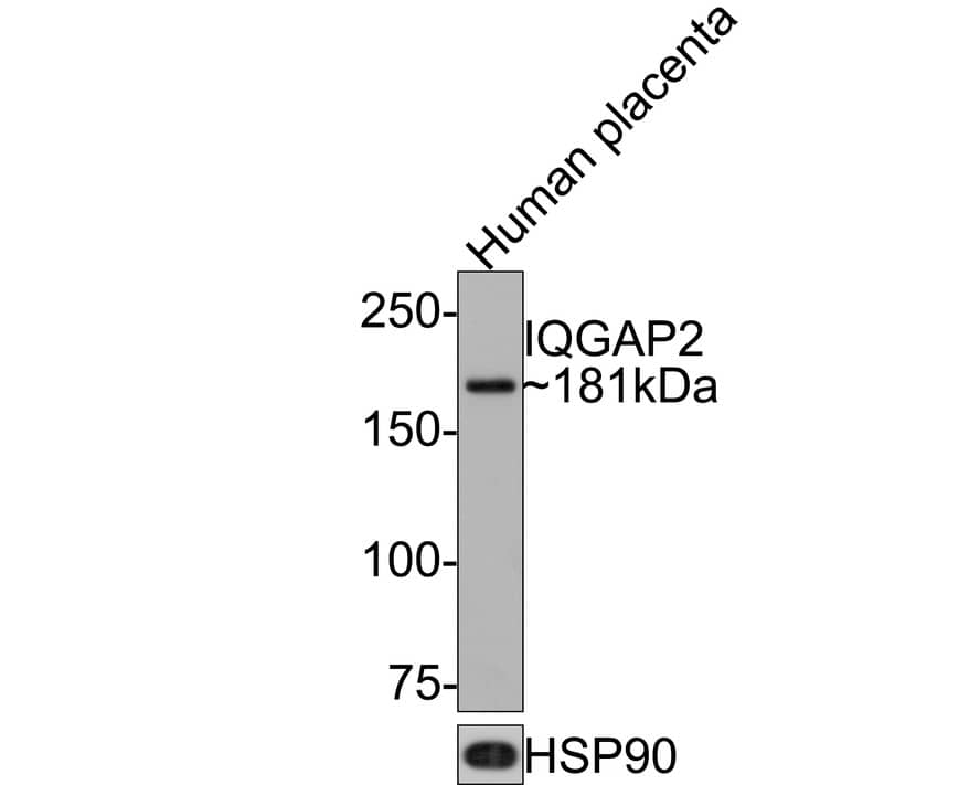 IQGAP2 Antibody (JE64-93)