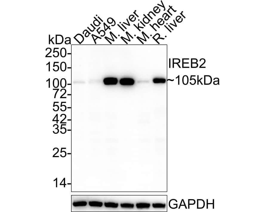 IRP2 Antibody (9D1-R)