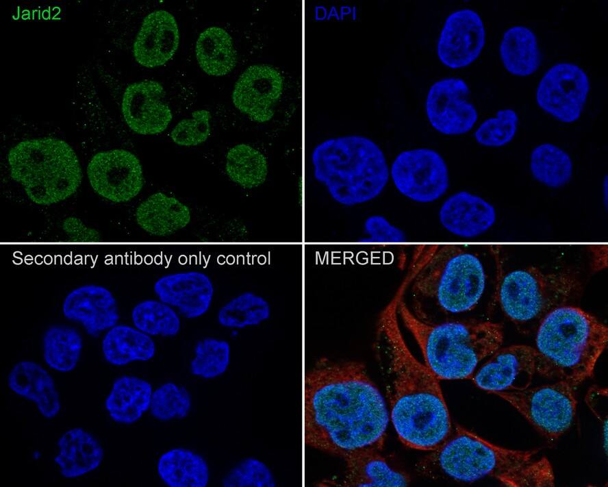Jumonji/JARID2 Antibody (PSH01-32)