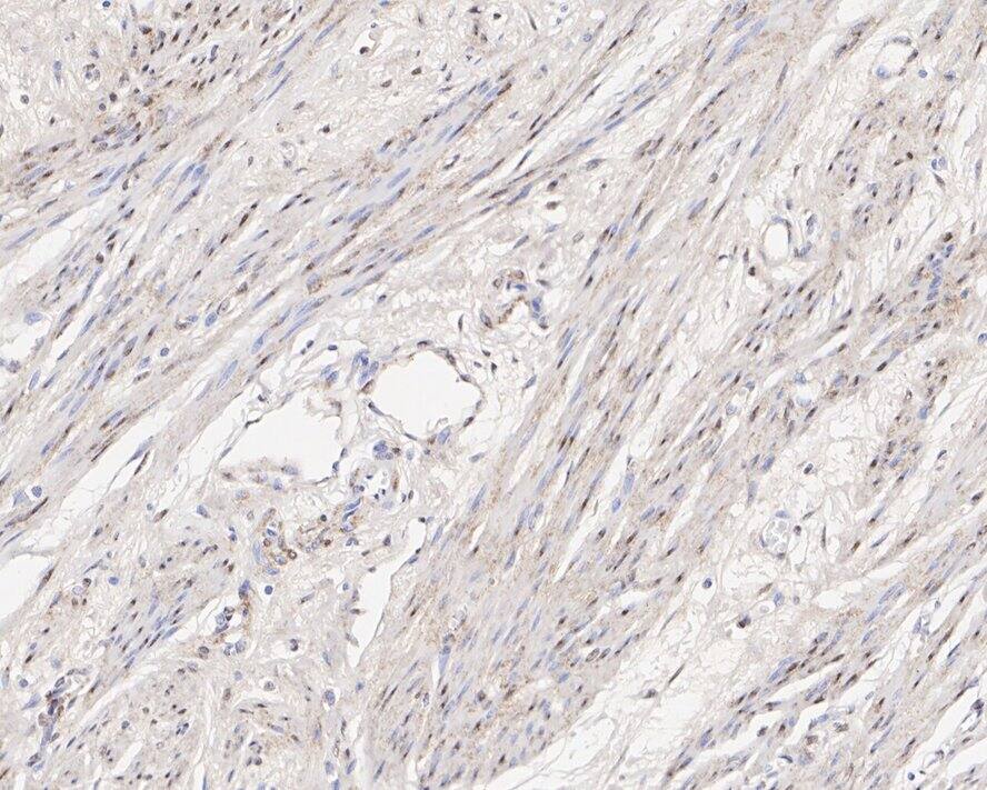 Jumonji/JARID2 Antibody (PSH01-32)