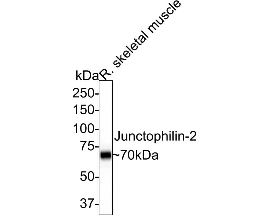 JPH2 Antibody (3-2-R)