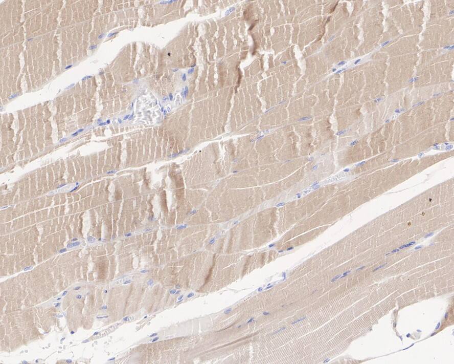 JPH2 Antibody (3-2-R)