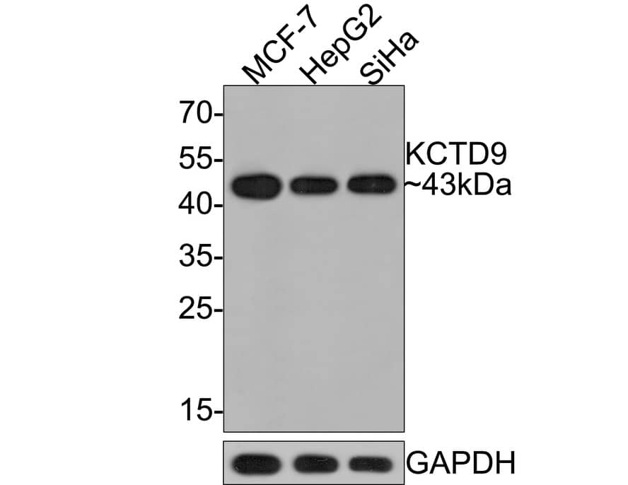 KCTD9 Antibody (JE64-67)