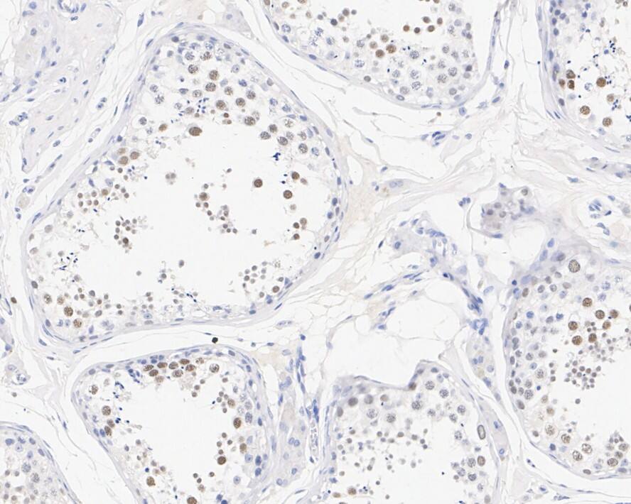 Lysine (K)-specific Demethylase 3A/KDM3A/JMJD1A Antibody (PSH01-77)