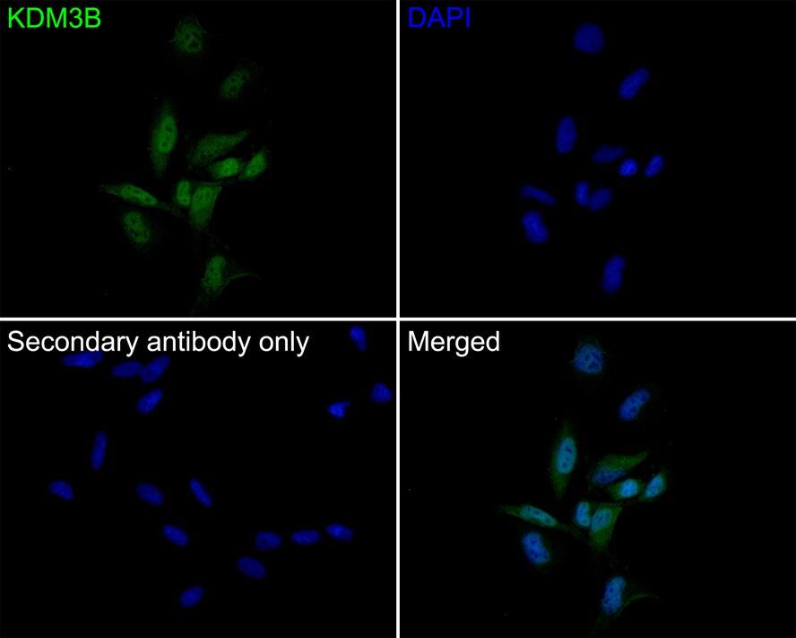 JMJD1B Antibody (1A8)