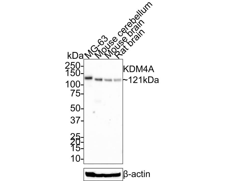 Lysine (K)-specific Demethylase 4A/KDM4A/JMJD2A Antibody (JE36-54)