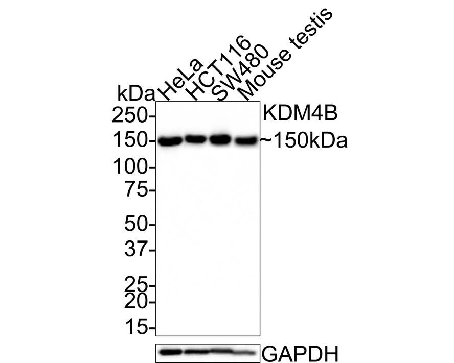 JMJD2B Antibody (JE36-58)