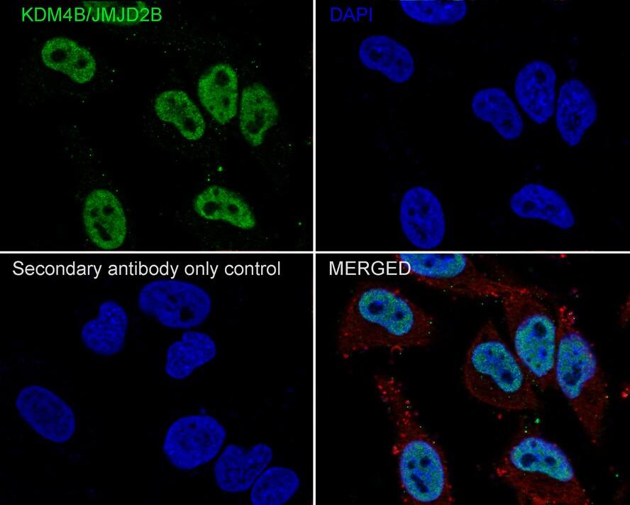JMJD2B Antibody (JE36-58)