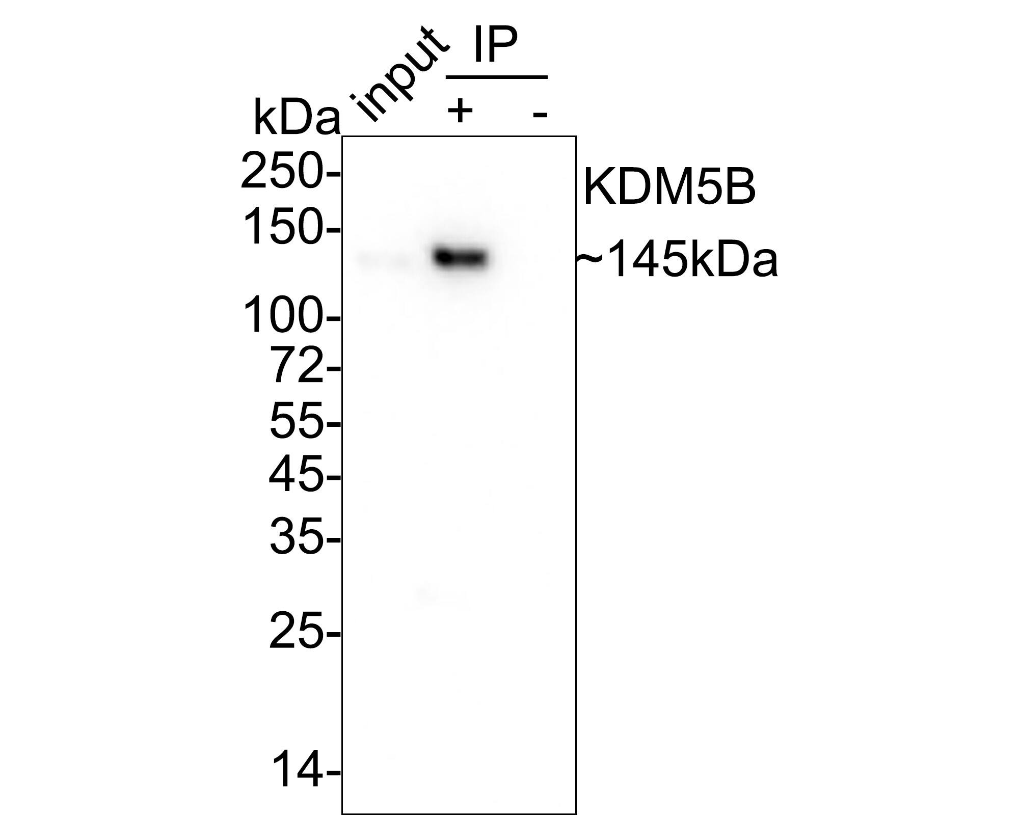 Lysine (K)-specific Demethylase 5B/KDM5B/JARID1B Antibody (PSH03-97)