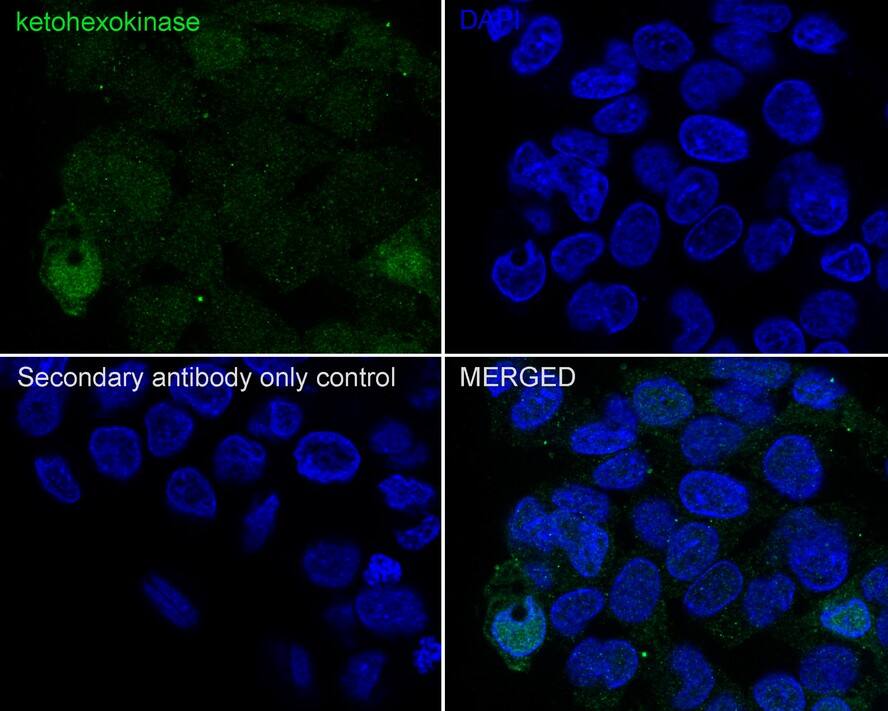 Ketohexokinase Antibody (PSH03-18)