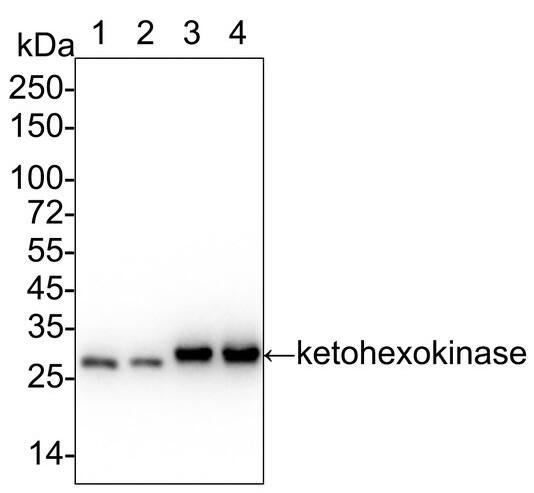 Ketohexokinase Antibody (PSH03-18)