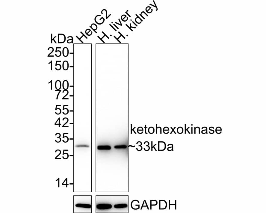 Ketohexokinase Antibody (PSH03-19)