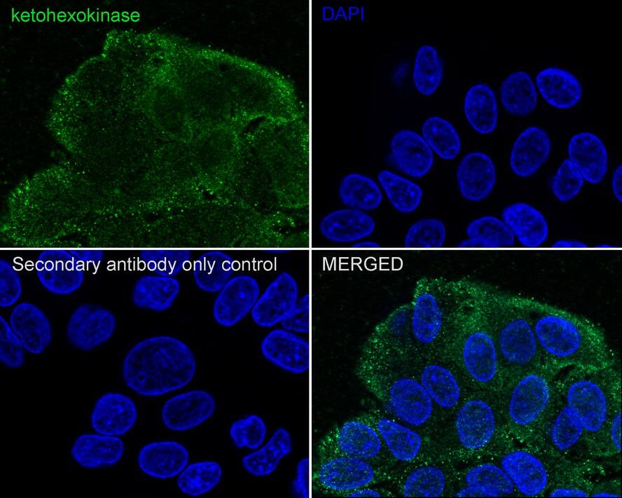 Ketohexokinase Antibody (PSH03-19)