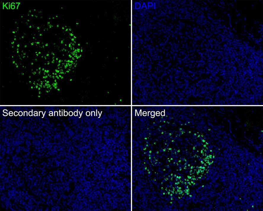 Ki67/MKI67 Antibody (SR00-02)