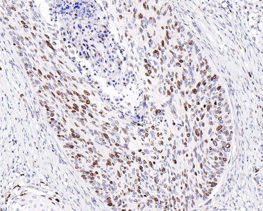 Ki67/MKI67 Antibody (PSH0-02)