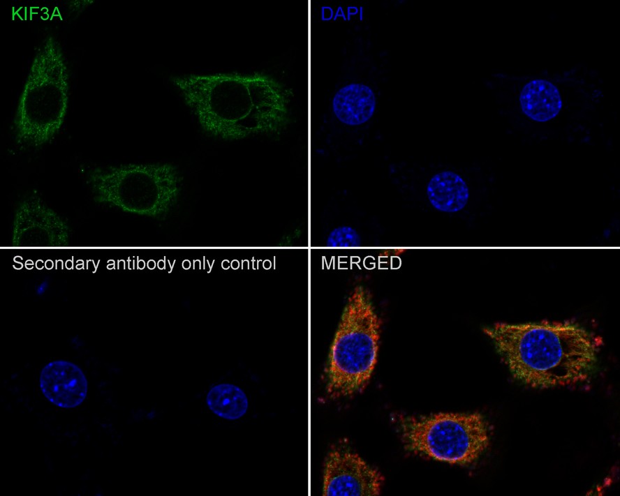 KIF3A Antibody (JE31-39)