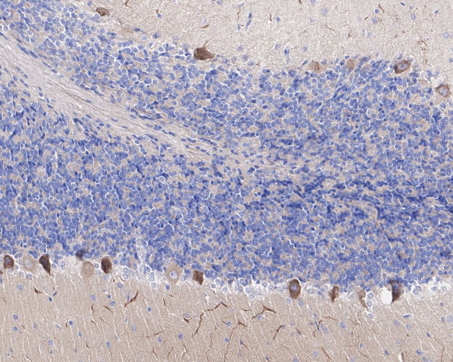 KIF3A Antibody (JE31-39)