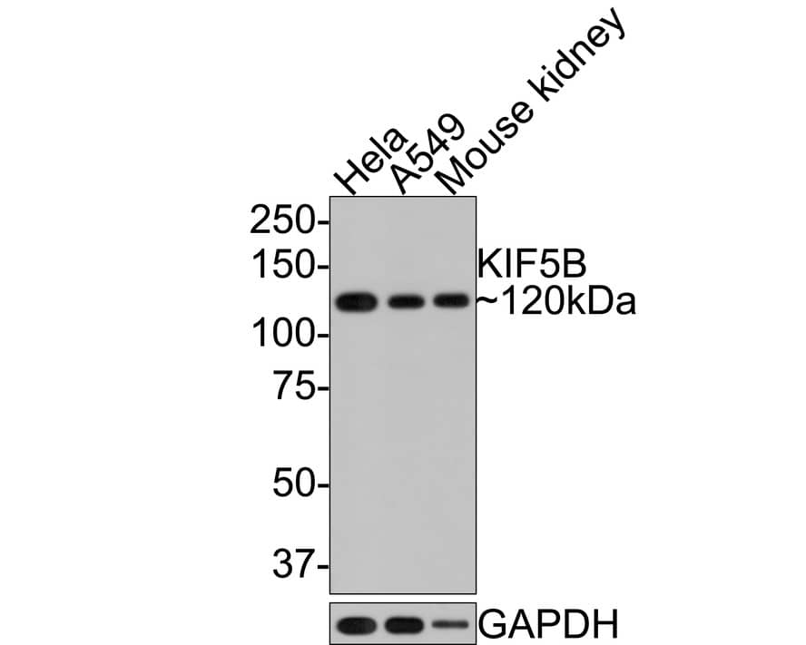 Kinesin 5B Antibody (JE64-16)